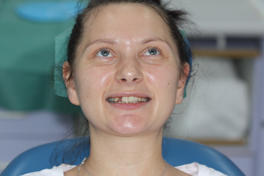 Dental Implants Leek